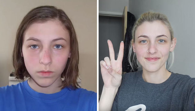 Teen's Creative Project Of Taking Selfies Every Day For 8 Years Proves That Small Changes Make A Huge Difference