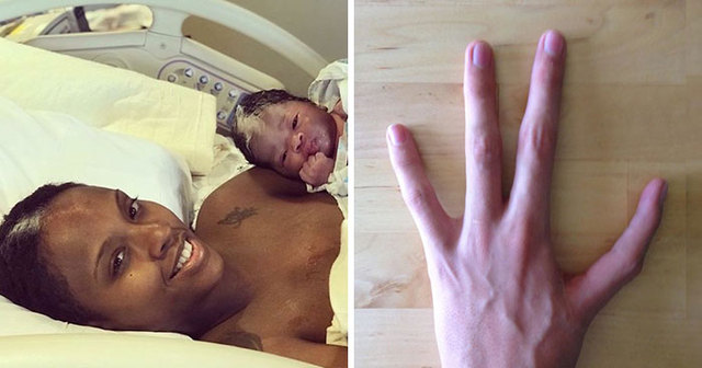 30 People Whose Unique Genetics Made Them Stand Out