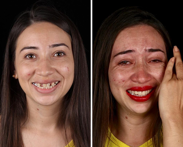 This Brazilian Dentist Travels The World And Fixes Poor People's Teeth For Free (30 Pics)