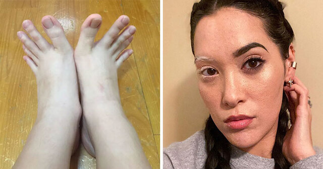 39 People Who Surprised Us With Their Unique Genetics