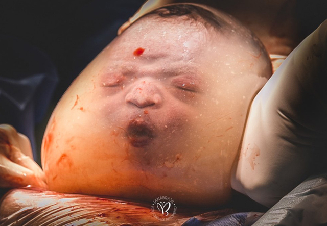 Here Are The 27 Winning Photos From The 2020 Birth Photography Competition (NSFW)