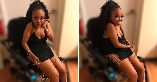 Disabled Woman Shares "Sexy" Pictures Of Herself, Receives Enormous Support From Her Followers