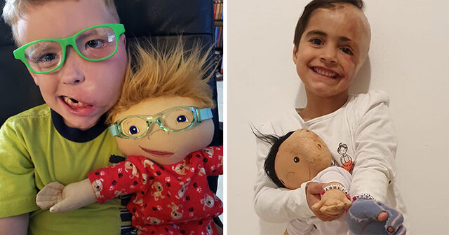 This Woman Creates Custom Dolls For Kids With Disabilities And People Love Them