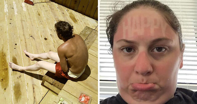 30 People Who Realized The Importance Of Sunscreen The Hard Way