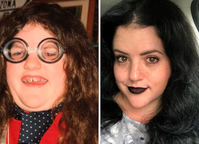 40 “Ugly Ducklings” You'll Barely Recognize After Their Amazing Transformations