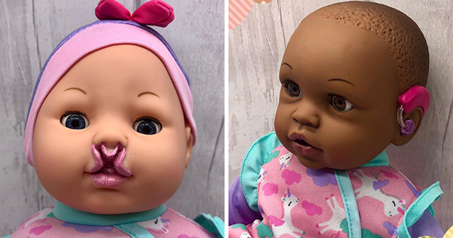 Mom Creates Inclusive Dolls So That Children With Medical Conditions Wouldn't Feel Left Out