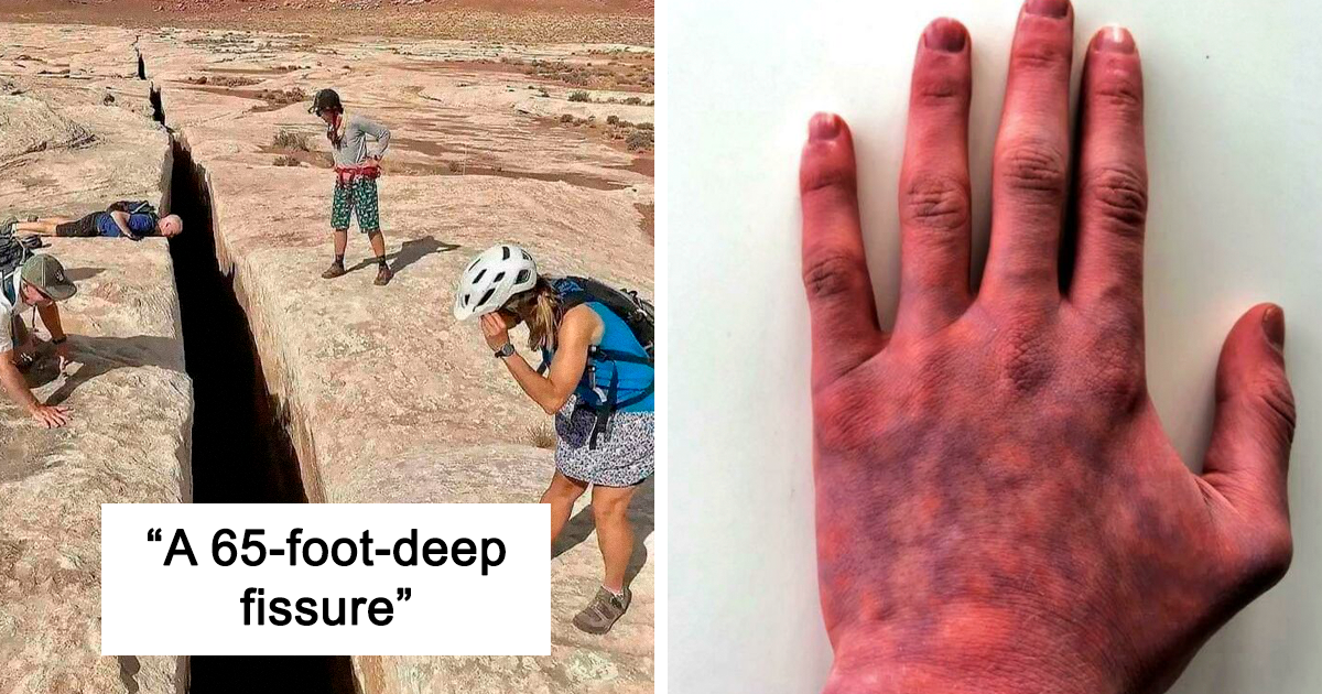 "Oddly Terrifying": This Online Group Shares The Most Unsettling Images And Here Are 30 Of Them