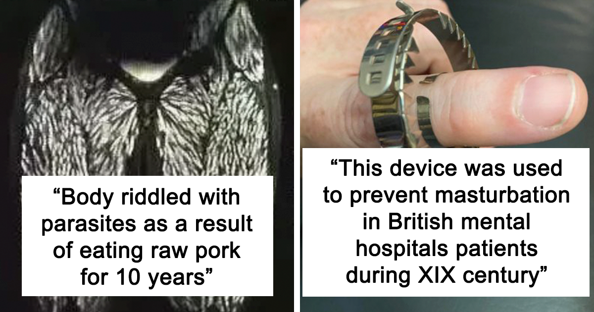 20 Most Creepy Posts Shared In The Online Community "Oddly Terrifying"