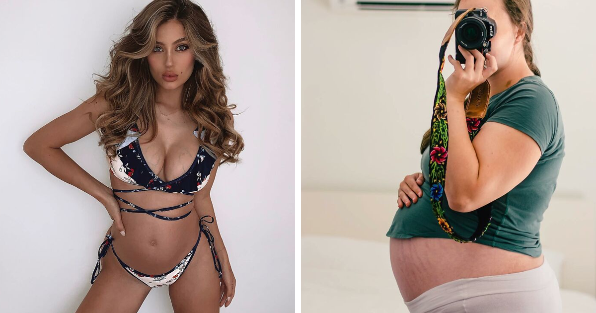 20 Women Shared Pictures Of Their Baby Bumps That Show Body Diversity During Pregnancy