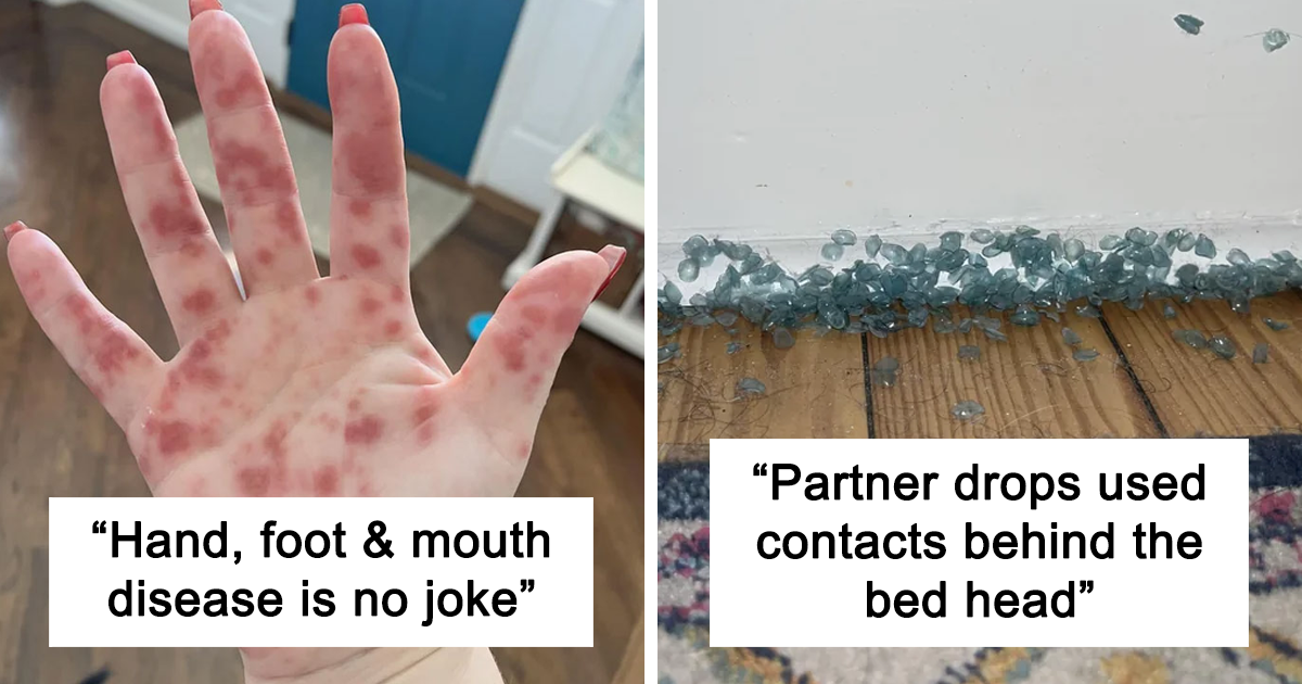 20 Disgusting Pictures That Are Oddly Fascinating, Taken From The Dedicated Group “Make Me Suffer”