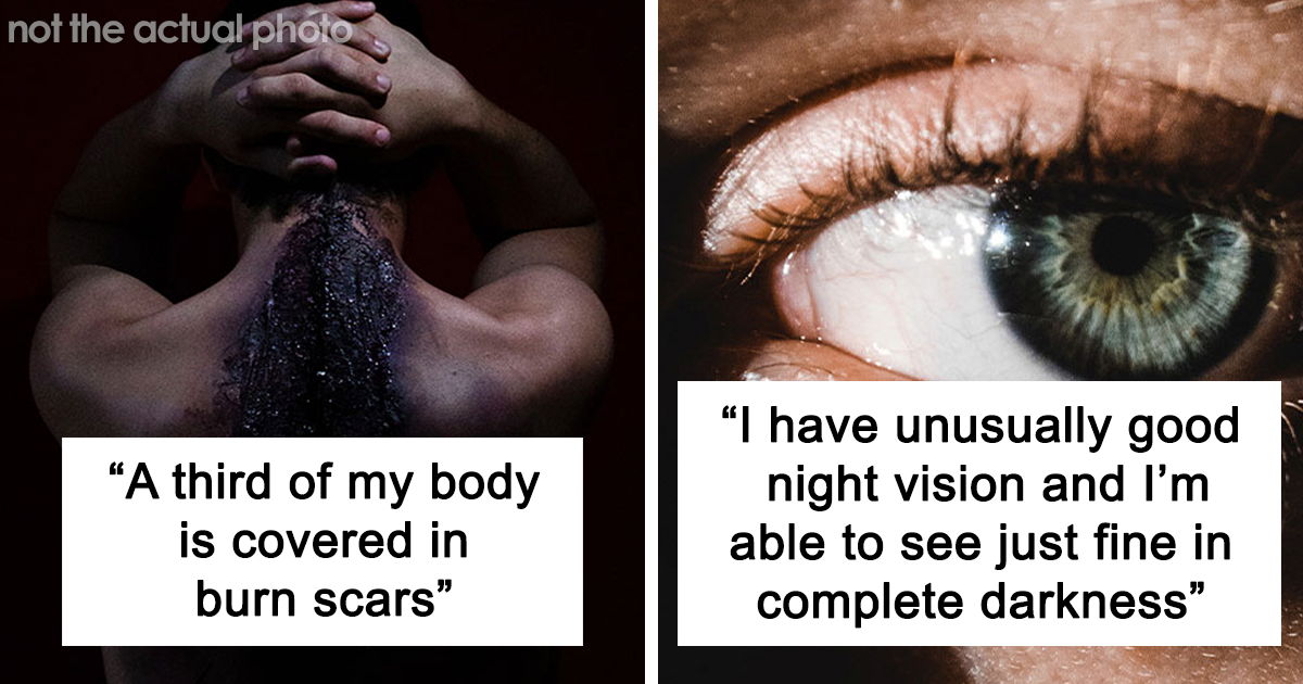 20 People Reveal Deeply Disturbing Secrets About Themselves