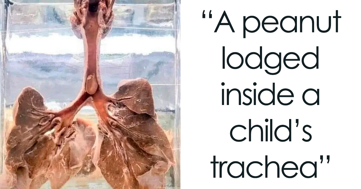 20 Interesting But Creepy Things Shared By This Twitter Account