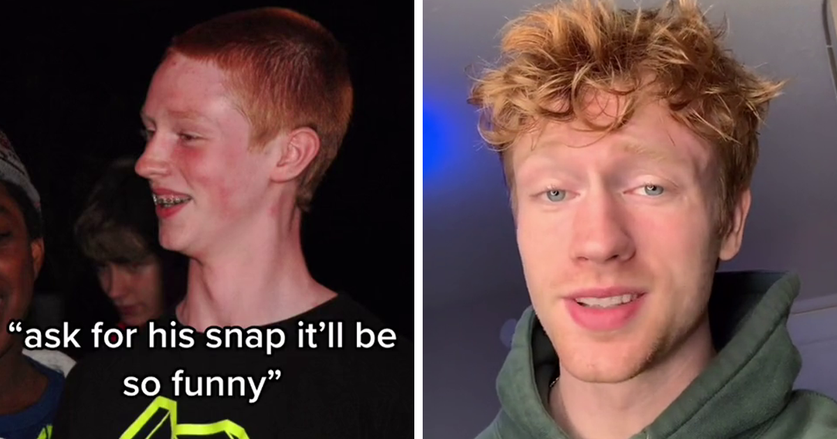 20 People Who Were Rejected By Someone As Being Too “Ugly” Proudly Share Their “Glow Ups”