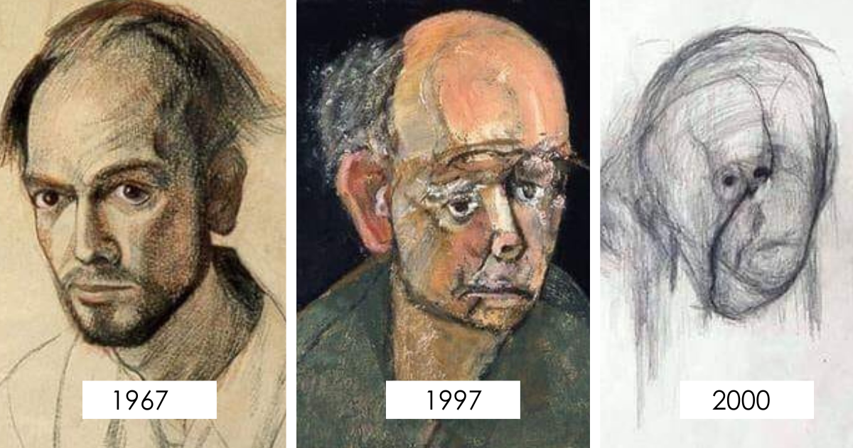 The Tragic Evolution Of Self-Portraits Of William Charles Utermohlen And His Battle With Alzheimer's