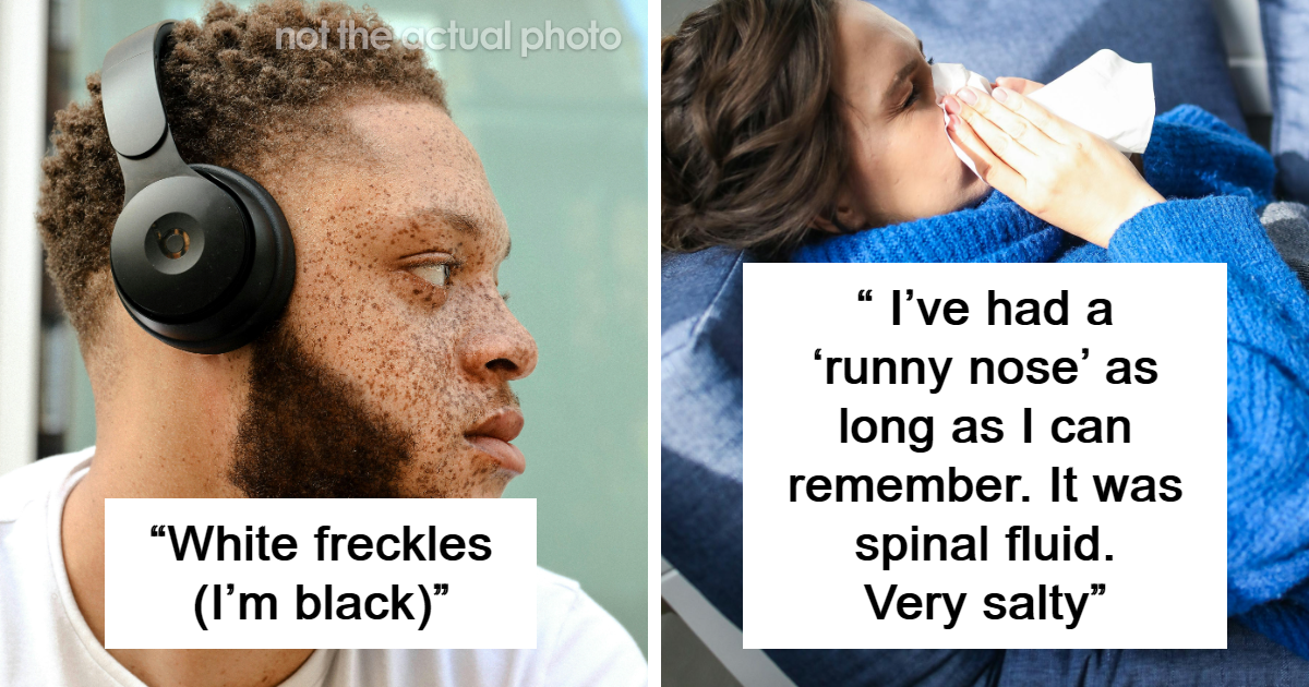 30 People Share The Most Abnormal Things About Their Bodies