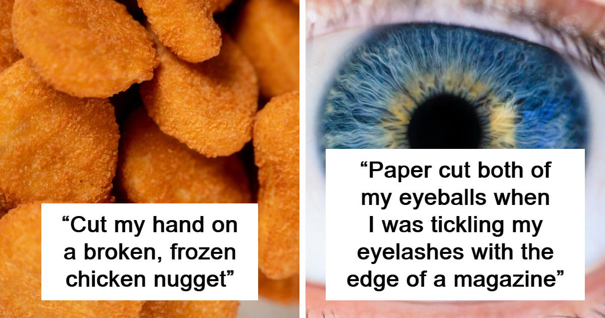25 Idiotic Ways In Which People Have Accidentally Injured Themselves