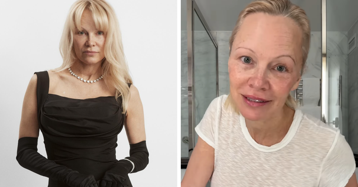 15 Unfiltered Photos Of Celebs That Are Keeping It Real