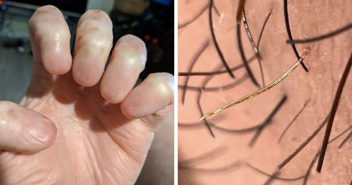 25 Absolutely Shocking Pics Of Things That Can Happen In The Human Body