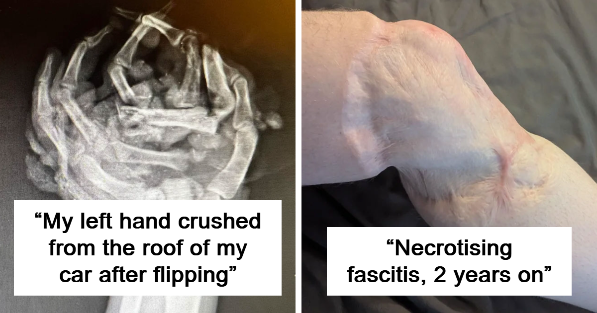 40 Photos Of Rare Body Features That Show Just How Unique Humans Can Be