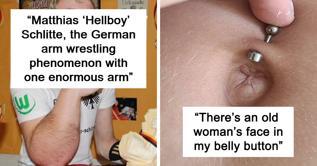 40 Photos Of Rare Body Features That Show Just How Unique Humans Can Be