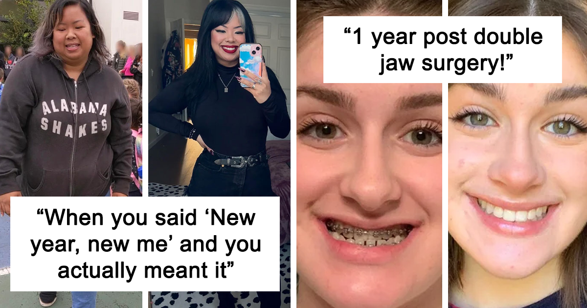 35 Women Share Photos Of The Before And After Of A Life-Altering Change
