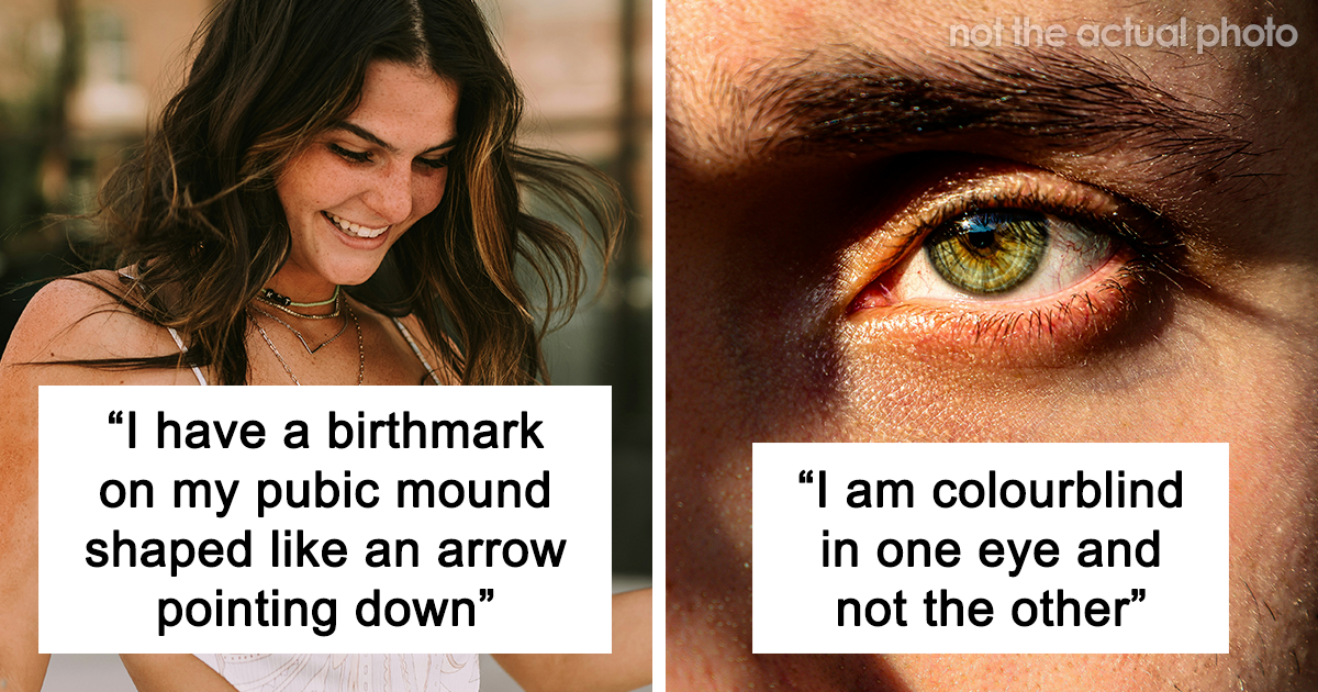 "My Kidneys Are Attached”: 25 Of The Randomest Body Quirks People Have