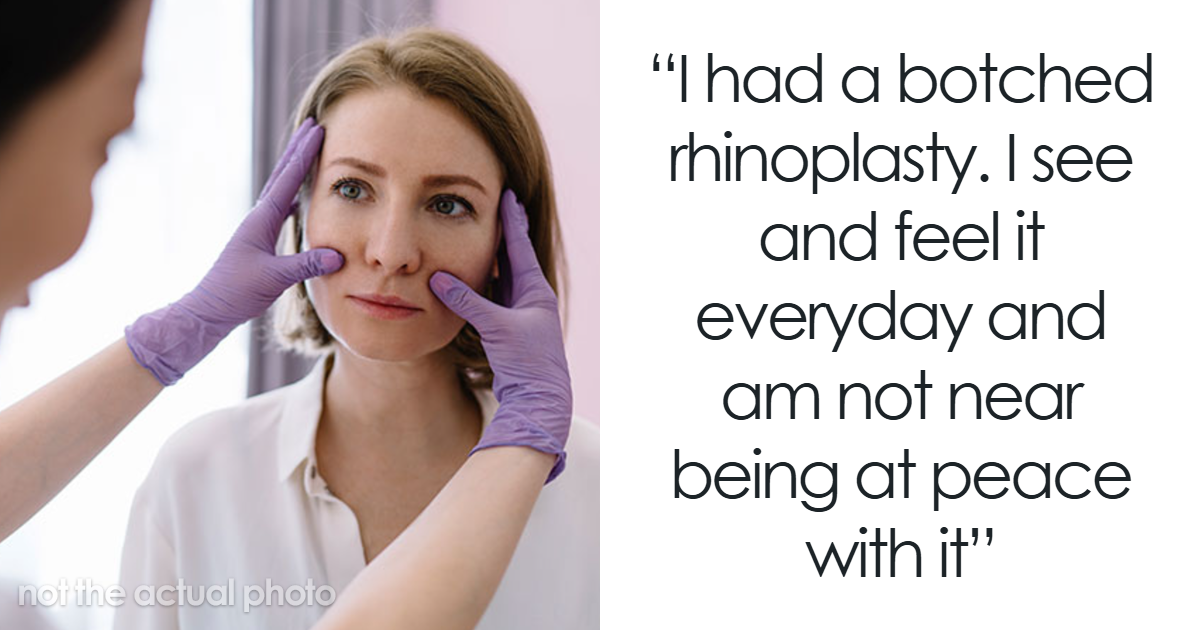 20 Unfortunate Times A Cosmetic Procedure Didn’t Go As Expected