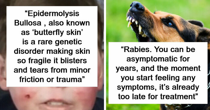 25 Of The Worst Diseases Known To Mankind, According To Netizens