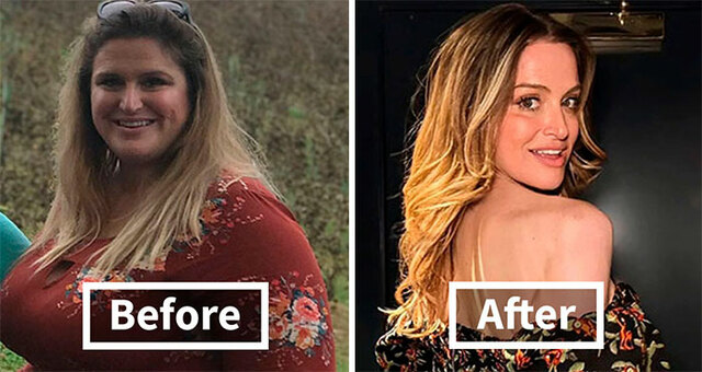 35 People Share Comparison Pics Of Their Before-And-After “Ozempic Faces”
