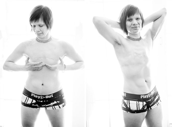 double-mastectomy-cancer-survivors-queer-lgbt-flattopper-pride-13