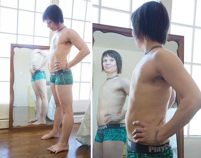 double-mastectomy-cancer-survivors-queer-lgbt-flattopper-pride-14