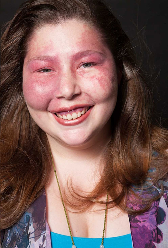 genetic-condition-glamour-shots-on-beauty-positive-exposure-rick-guidotti-18