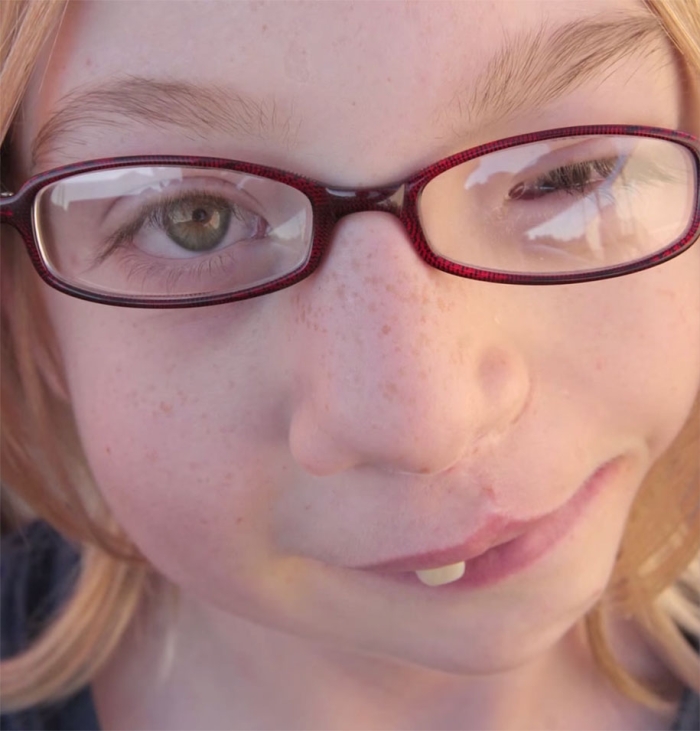 genetic-condition-glamour-shots-on-beauty-positive-exposure-rick-guidotti-11