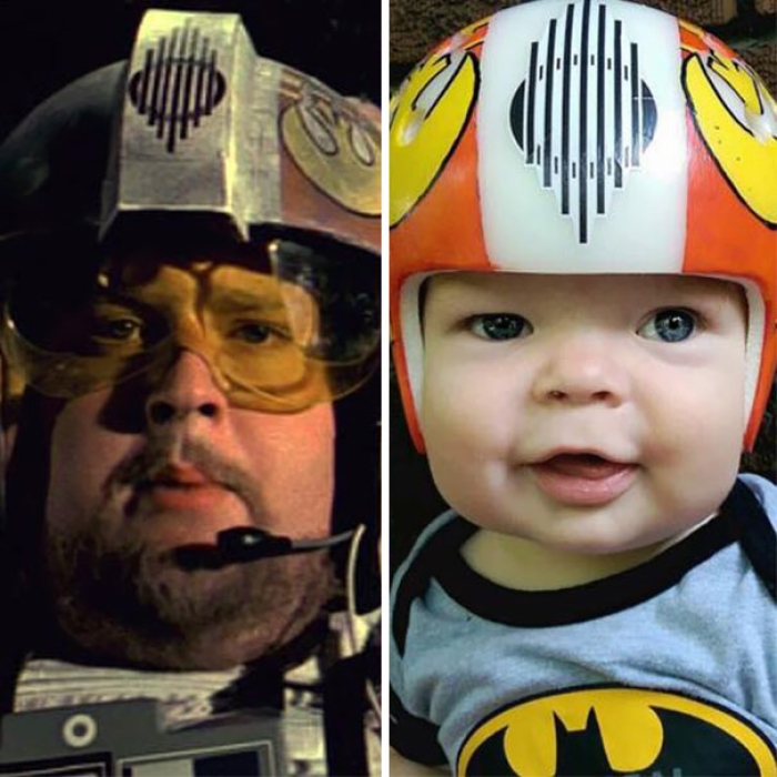craniosynostosis-head-shaping-star-wars-helmets-mikesweeney-4