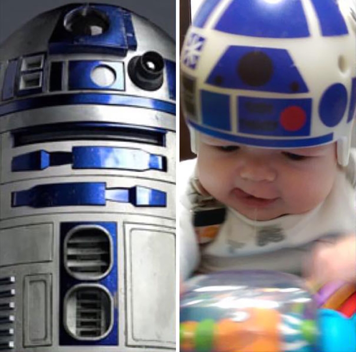 craniosynostosis-head-shaping-star-wars-helmets-mikesweeney-1