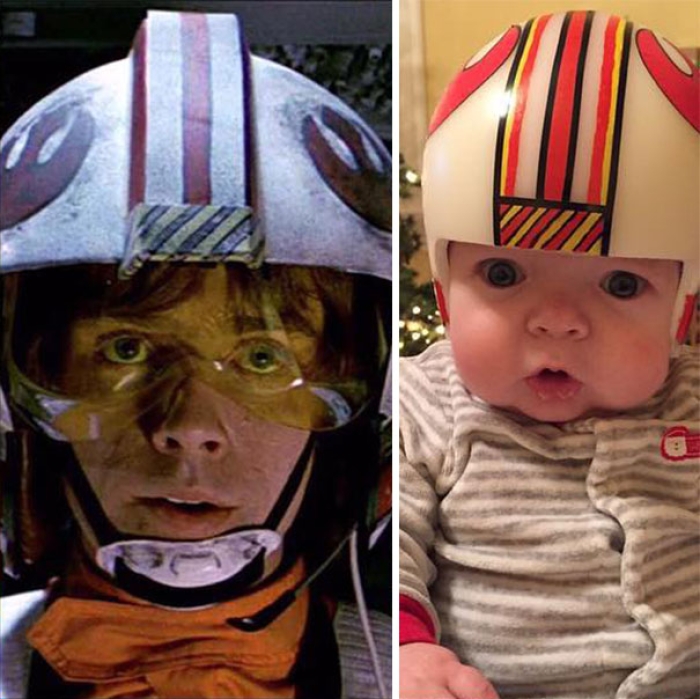 craniosynostosis-head-shaping-star-wars-helmets-mikesweeney-2