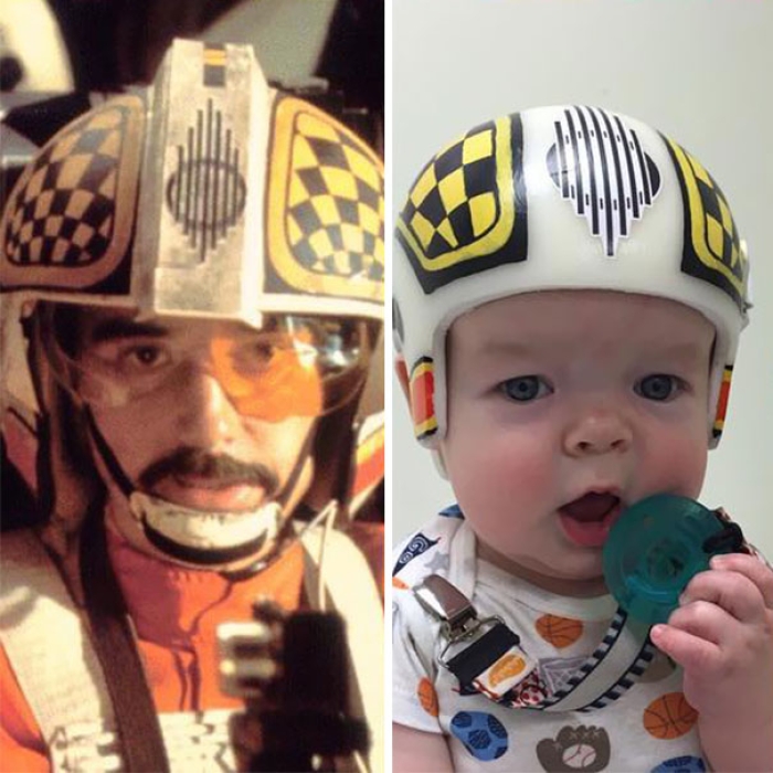 craniosynostosis-head-shaping-star-wars-helmets-mikesweeney-3