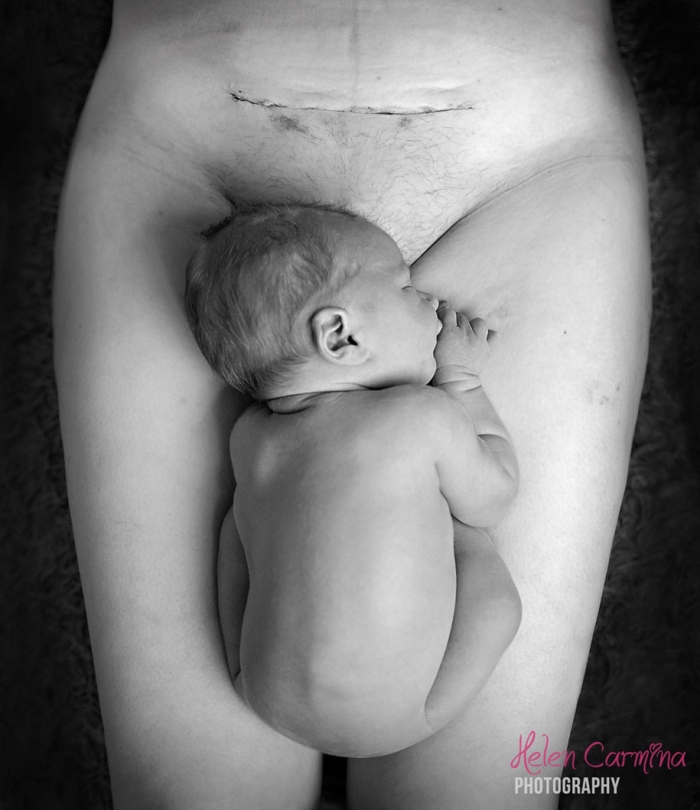 cesarean-section-scar-mother-baby-photography-helen-carmina-1