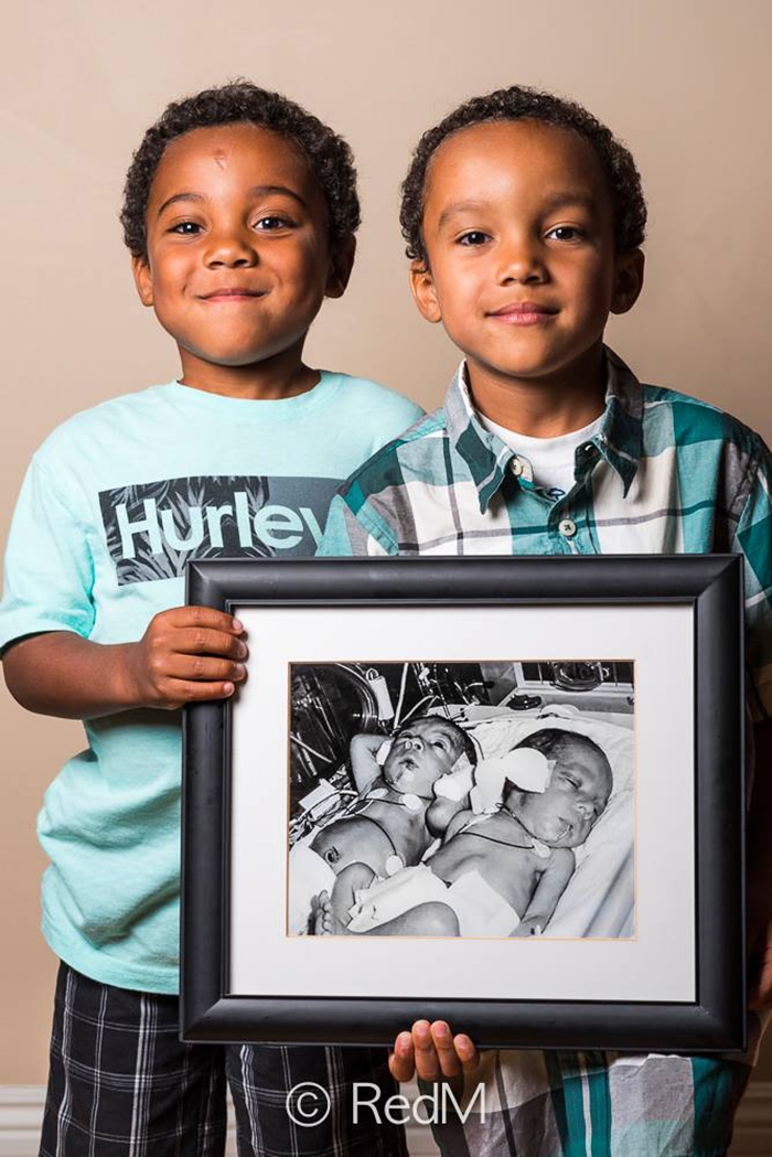 premature-baby-portraits-frame-les-premas-red-methot-5
