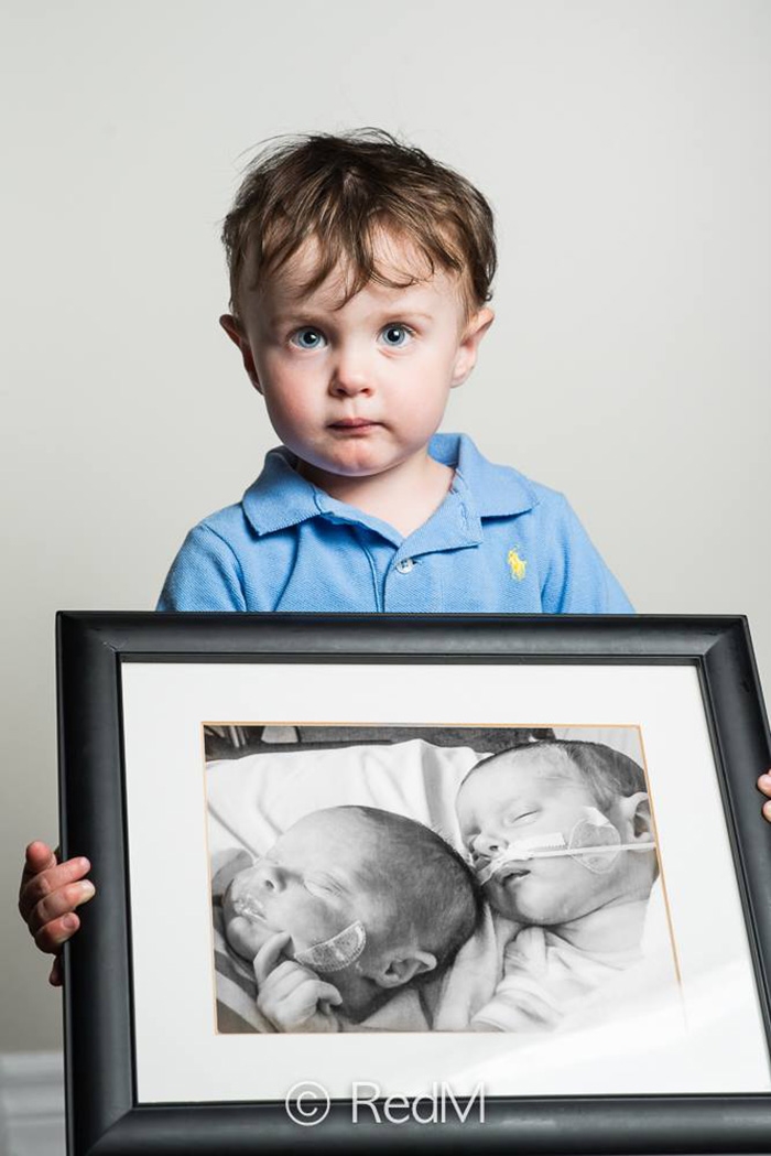 premature-baby-portraits-frame-les-premas-red-methot-8