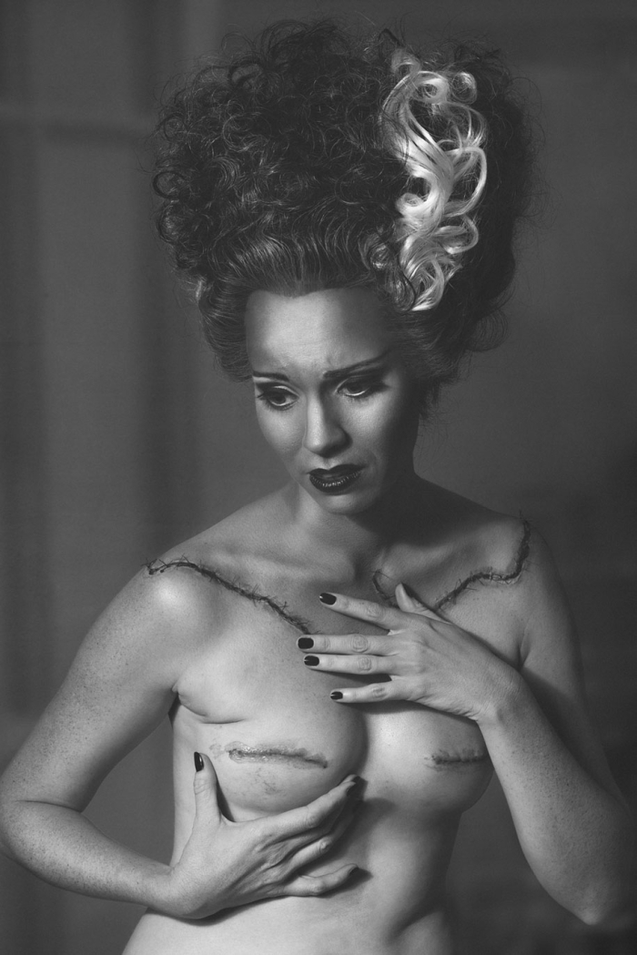 cancer-mastectomy-photo-series-my-breast-choice-aniela-mcguinness-2