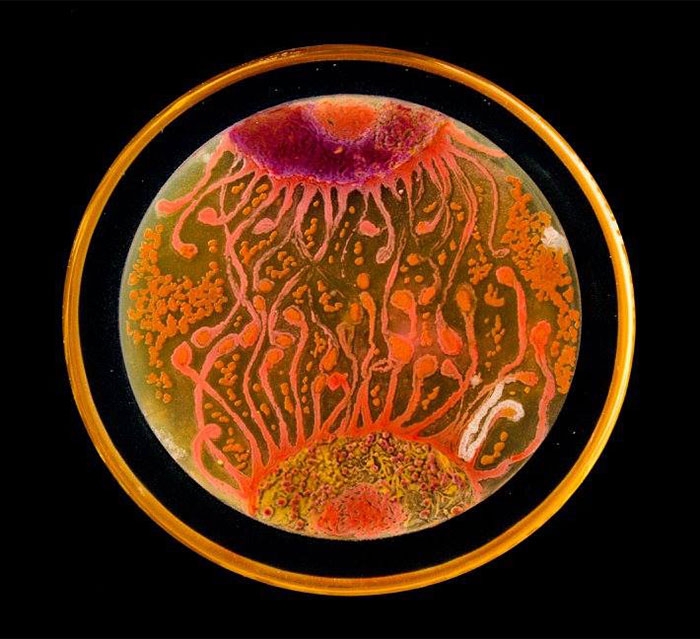 agar-jelly-petri-dish-microbe-bacteria-art-van-gogh-starry-night-2