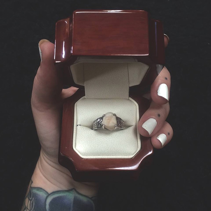 wisdom-tooth-wedding-engagement-ring-carlee-leifkes-lucas-unger-6