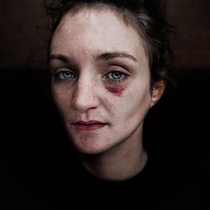 black-white-homeless-portraits-lee-jeffries-5