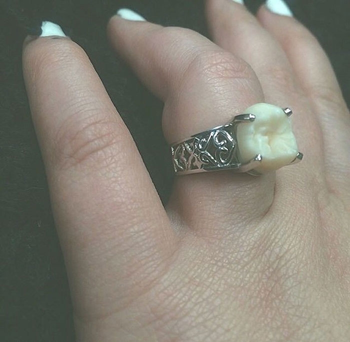 wisdom-tooth-wedding-engagement-ring-carlee-leifkes-lucas-unger-3