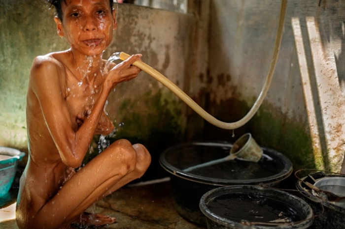shocking-photos-mental-illness-taboo-indonesia-andrea-star-reese-3-18