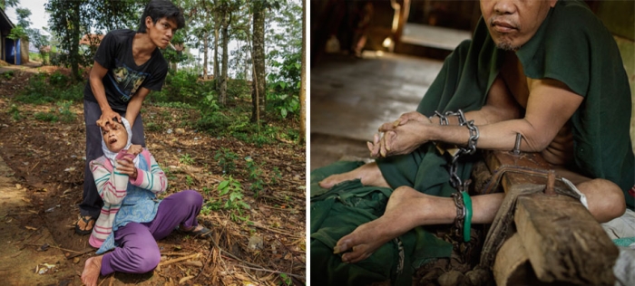 shocking-photos-mental-illness-taboo-indonesia-andrea-star-reese-3-25