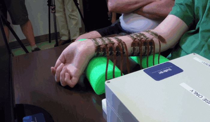 paralyzed-man-moves-hand-after-5-years-11