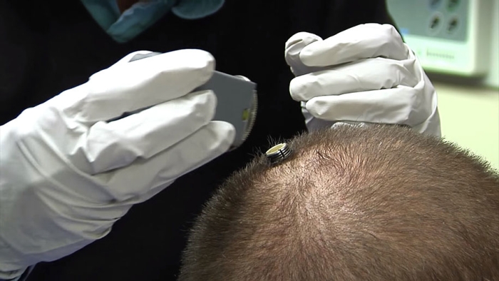 paralyzed-man-moves-hand-after-5-years-3