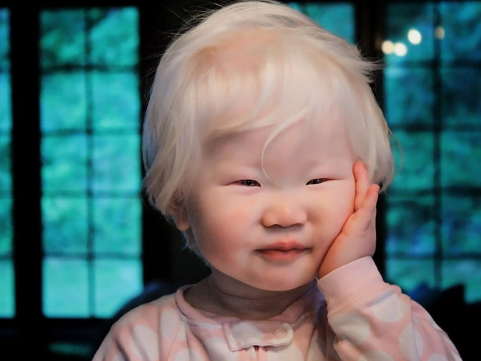 albinism-beautiful-albino-people-7